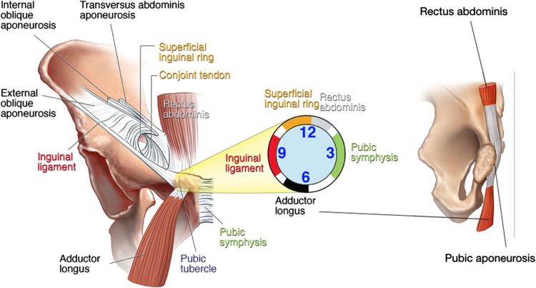 groin-pain